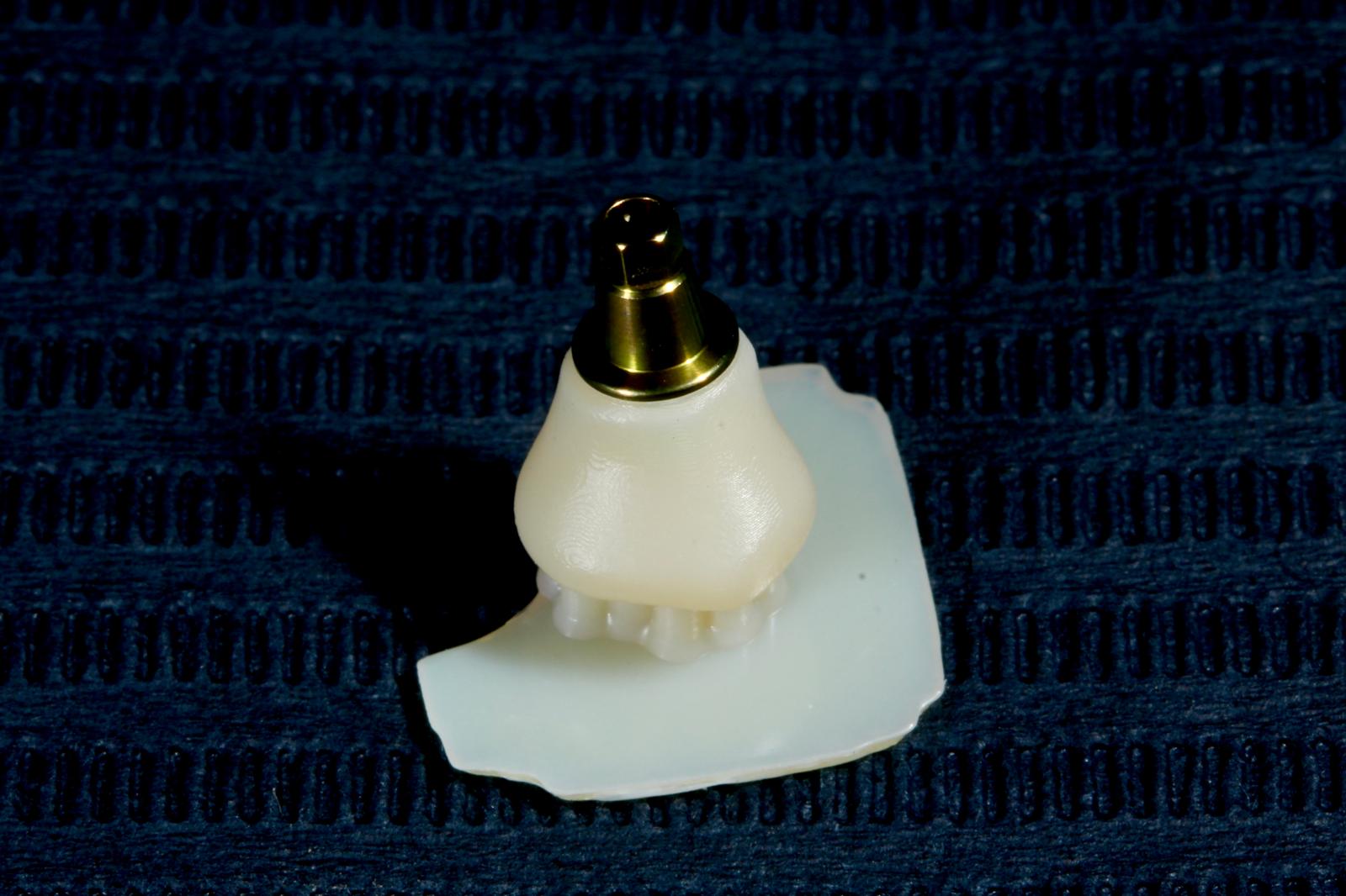 Perfil de emergencia customizado